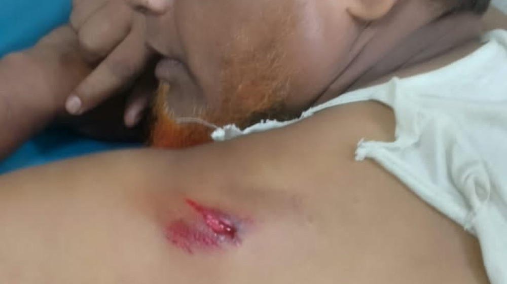 মহাদেবপুরের সিনিয়র সাংবাদিক লিয়াকত আলী বাবলু সড়ক দুর্ঘটনায় আহত
