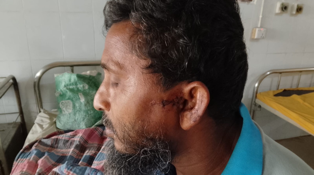 কুড়িগ্রামে ৮ শতক জমি দখলচেষ্টার অভিযোগ, অস্ত্রের আঘাতে আহত মা-ছেলে